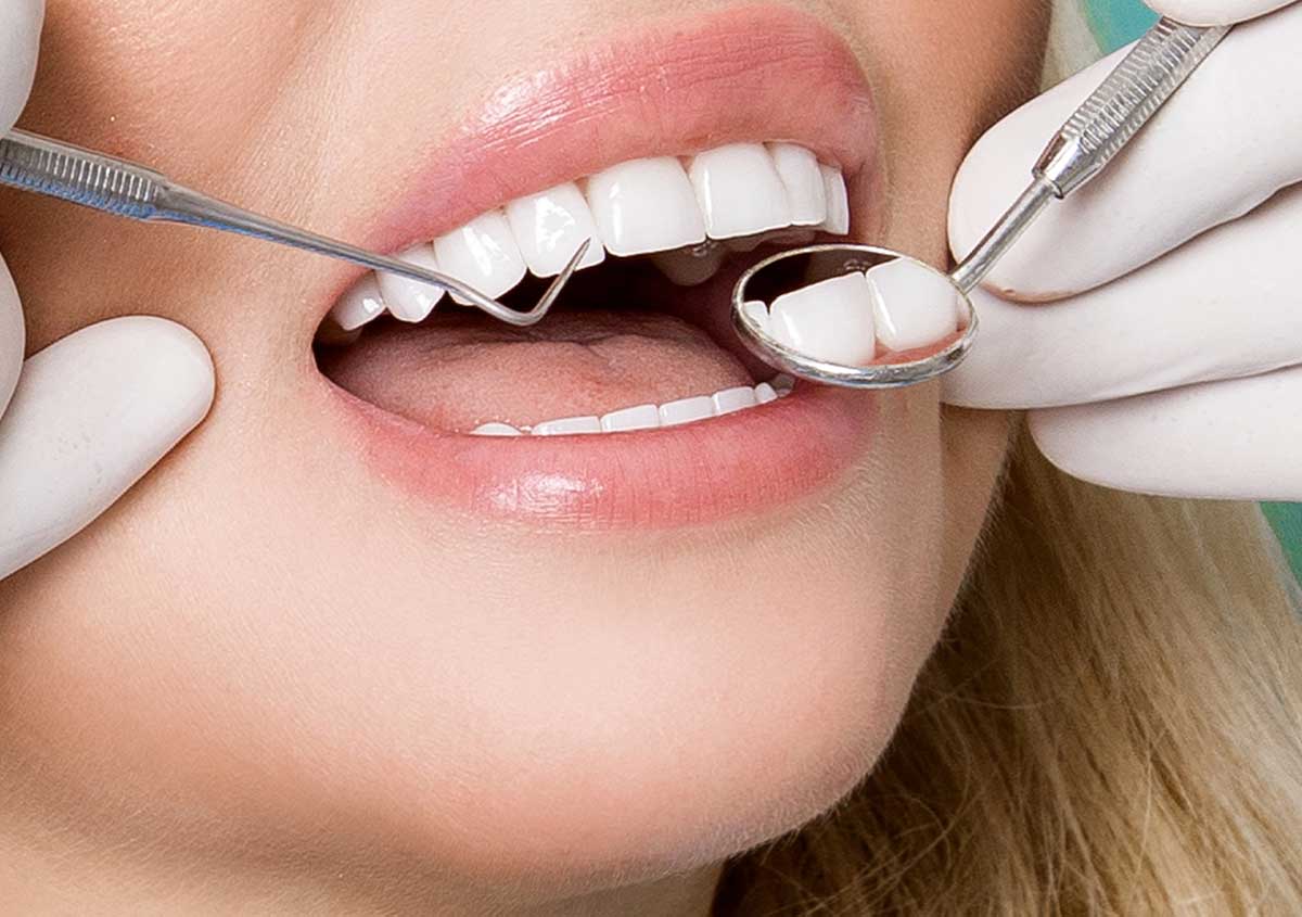 What’s the Danger of Plaque Buildup on Your Teeth?