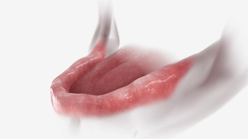 Dental Implants explanation in best restorative dentistry option