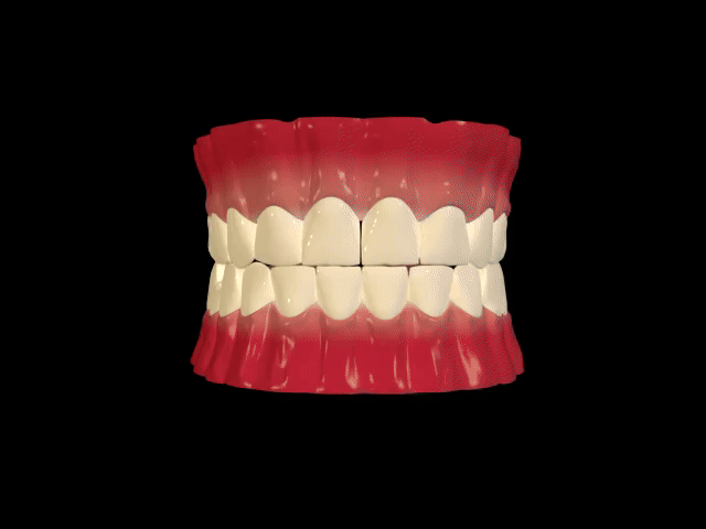 Dental Crowns placement Procedure explained