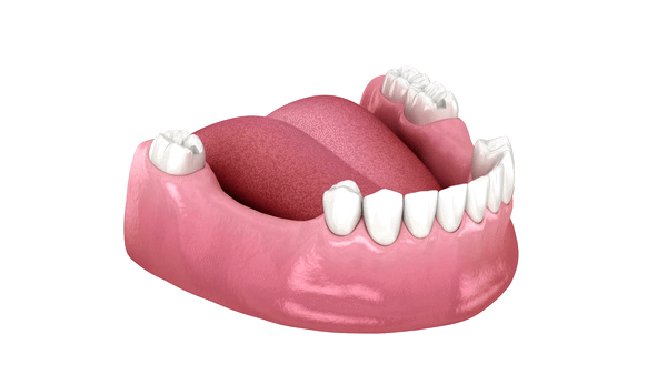 Dentures and Partials placement Procedure explained