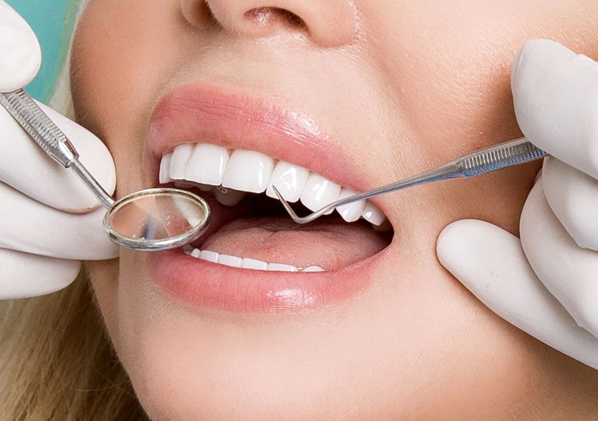 How Do Front Teeth Veneers Improve Your Smile? Answers for Ormond Beach Residents